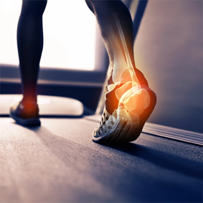 A person walking on a treadmill with inflammation in their joints showing by red highlighting